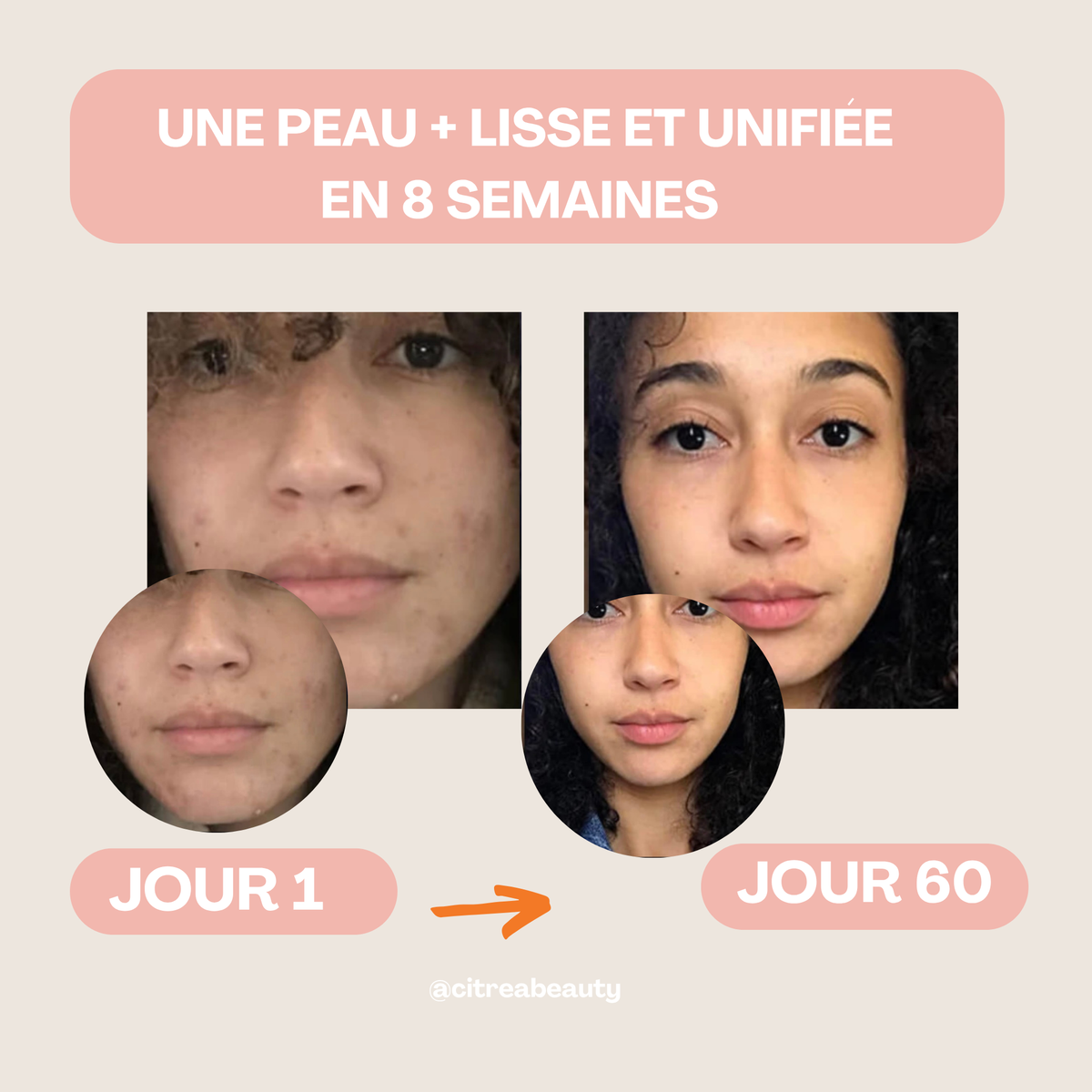 Pads Nettoyants au Curcuma 3 en 1