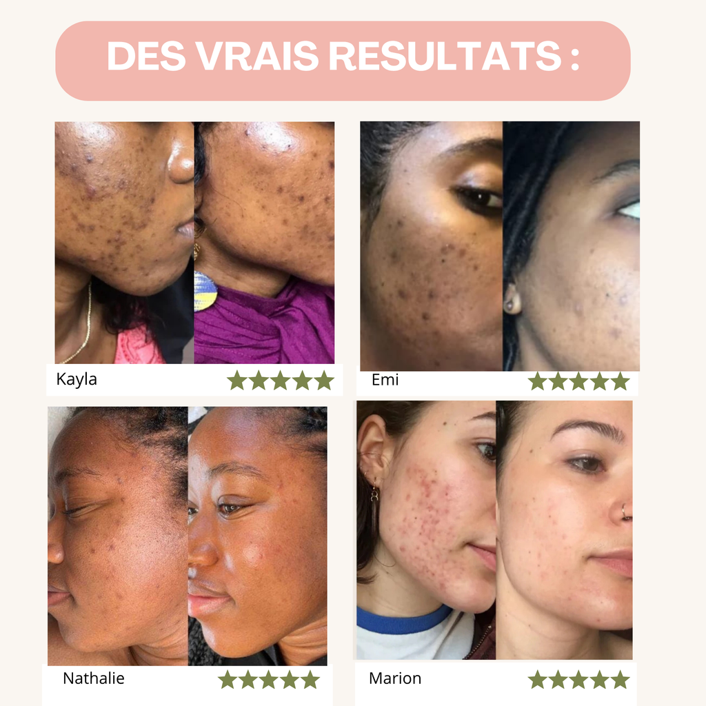 Pads Nettoyants au Curcuma 3 en 1