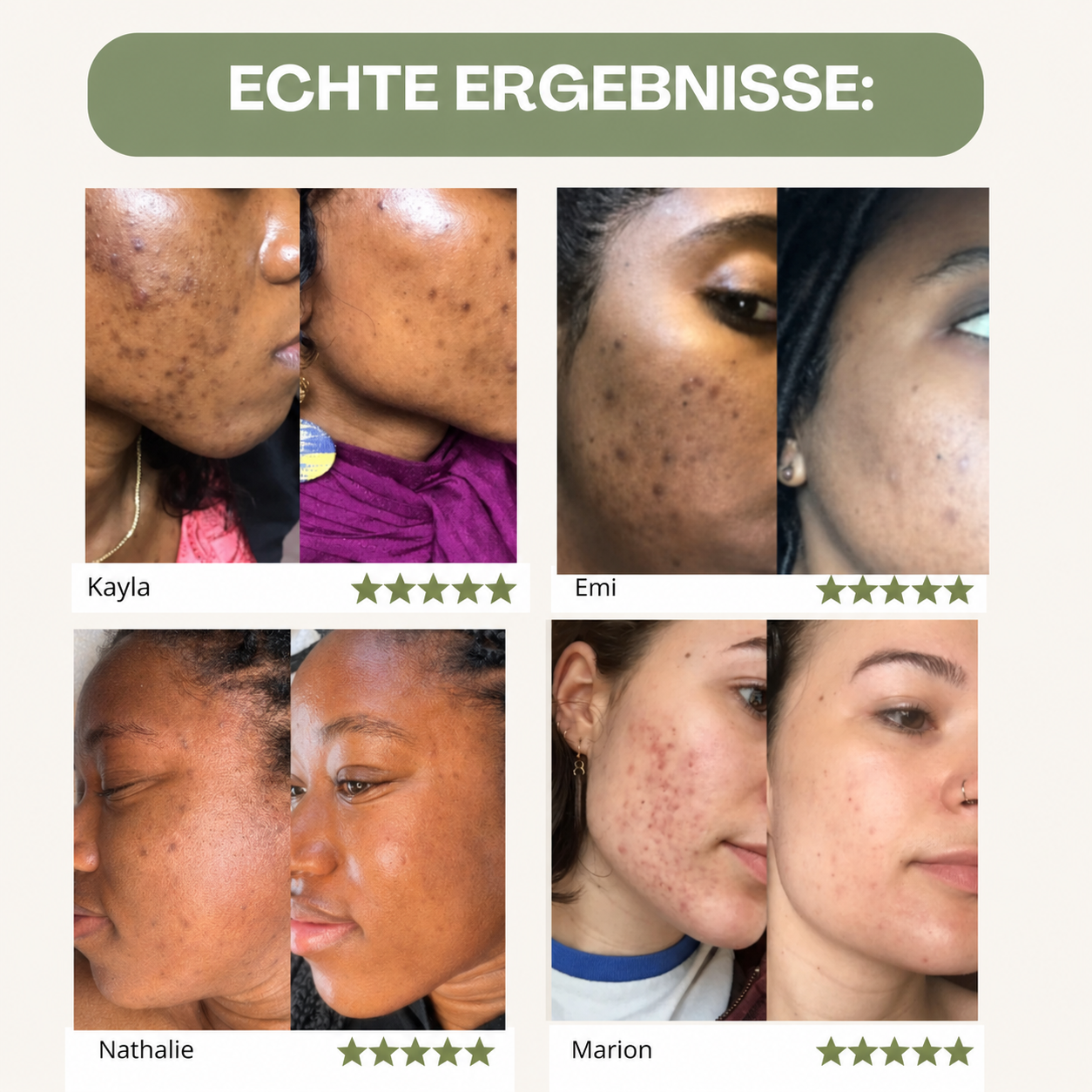 3-in-1 Kurkuma Reinigungspads für strahlende Haut