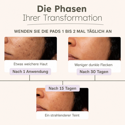 3-in-1 Kurkuma Reinigungspads für strahlende Haut