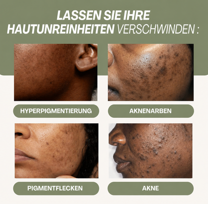 3-in-1 Kurkuma Reinigungspads für strahlende Haut